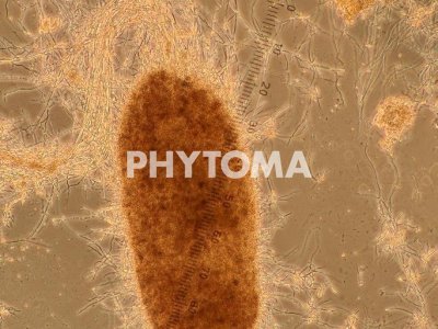 Metarhizium brunneum